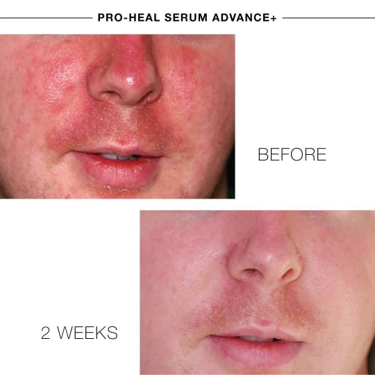 Pro-Heal Serum Advance+