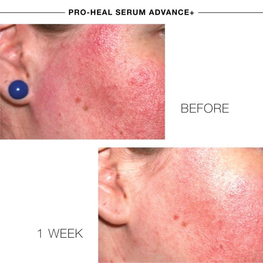 Pro-Heal Serum Advance+