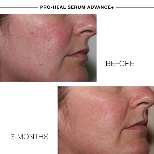 Pro-Heal Serum Advance+