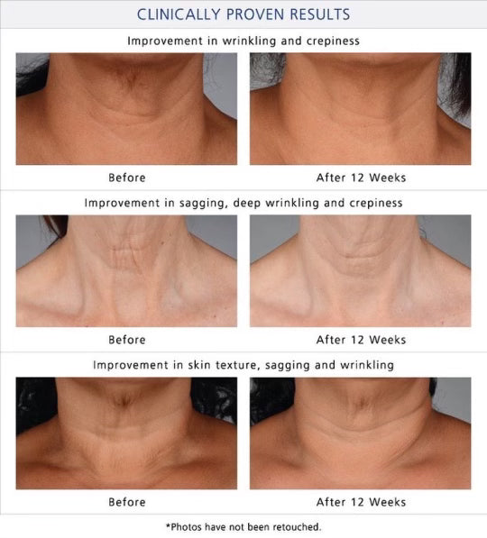 NeckPerfect Complex