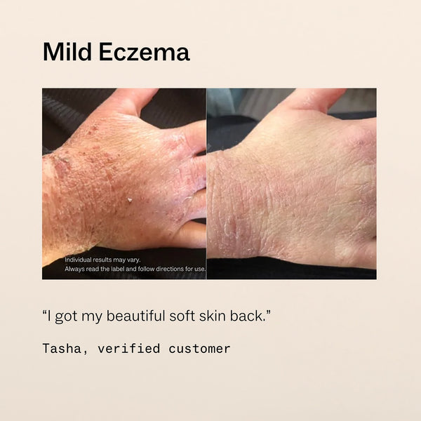 Skin + Gut Supplements