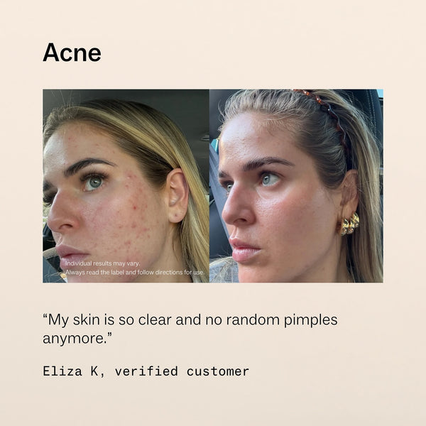 Skin + Gut Supplements