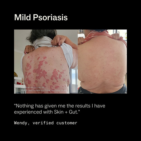 Skin + Gut Supplements